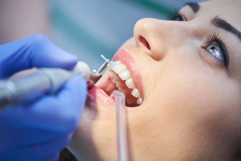 dental-patient-undergoing-teeth-cleaning.