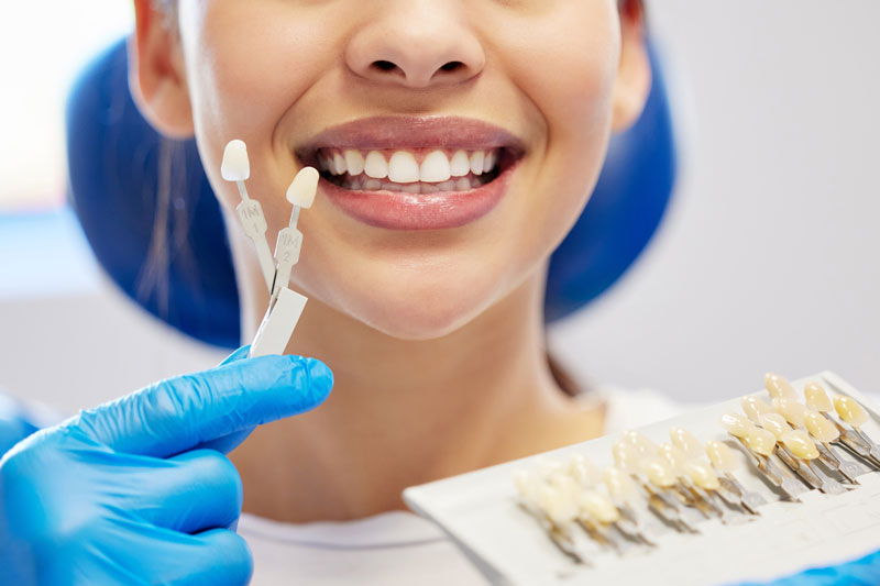 a dentist holding up a color matching tray to the patient to make her veneers