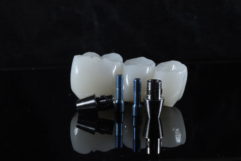 a dental bridge being shown with dental implants next to it